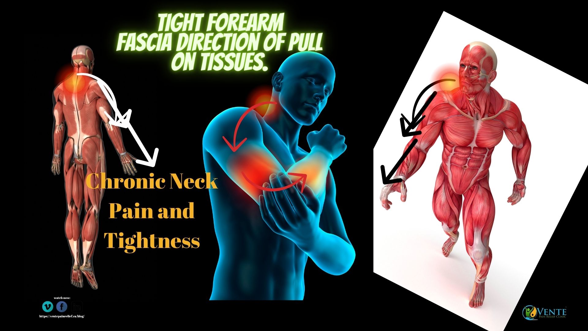 neck pain and tight fascia