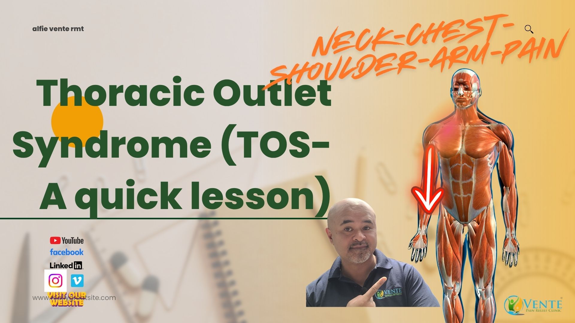 Alfie Vente pointing to a figure showing an arrow pointing down the arm towards the hand. This indicates the potential pain pattern of Thoracic Outlet Syndrome.